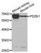PDZ Domain Containing 1 antibody, A5321, ABclonal Technology, Western Blot image 