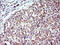 Toll Interacting Protein antibody, M02039-1, Boster Biological Technology, Immunohistochemistry paraffin image 