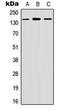 Misshapen Like Kinase 1 antibody, LS-C358810, Lifespan Biosciences, Western Blot image 