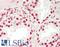 Sp1 Transcription Factor antibody, LS-B14621, Lifespan Biosciences, Immunohistochemistry paraffin image 