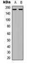 Eukaryotic Translation Initiation Factor 4 Gamma 1 antibody, LS-B14569, Lifespan Biosciences, Western Blot image 