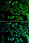 Jumonji Domain Containing 7 antibody, LS-C349122, Lifespan Biosciences, Immunofluorescence image 