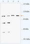 ABR Activator Of RhoGEF And GTPase antibody, TA310088, Origene, Western Blot image 