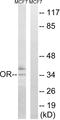 Olfactory Receptor Family 51 Subfamily H Member 1 antibody, A30912, Boster Biological Technology, Western Blot image 