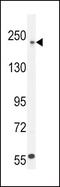 Collagen Type V Alpha 1 Chain antibody, PA5-23989, Invitrogen Antibodies, Western Blot image 