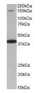 Insulin Receptor Substrate 4 antibody, orb12271, Biorbyt, Western Blot image 