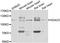 Histone Deacetylase 5 antibody, LS-C746747, Lifespan Biosciences, Western Blot image 