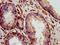 Interleukin-24 antibody, LS-C395504, Lifespan Biosciences, Immunohistochemistry paraffin image 