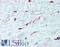 Platelet Derived Growth Factor Receptor Alpha antibody, LS-B2172, Lifespan Biosciences, Immunohistochemistry frozen image 