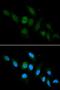 HLA class I histocompatibility antigen, A-3 alpha chain antibody, LS-B13866, Lifespan Biosciences, Immunofluorescence image 