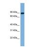 Actin Filament Associated Protein 1 antibody, NBP1-56581, Novus Biologicals, Western Blot image 