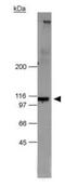 Nucleotide Binding Oligomerization Domain Containing 2 antibody, GTX30694, GeneTex, Western Blot image 