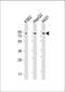 RETII antibody, M02176, Boster Biological Technology, Western Blot image 