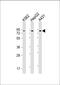 Golgin A5 antibody, M02176, Boster Biological Technology, Western Blot image 