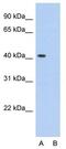 Poly(RC) Binding Protein 1 antibody, GTX47350, GeneTex, Western Blot image 