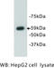 Autoimmune Regulator antibody, MBS355133, MyBioSource, Western Blot image 