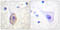 Fms Related Tyrosine Kinase 1 antibody, LS-C117727, Lifespan Biosciences, Immunohistochemistry frozen image 