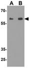 Kirre Like Nephrin Family Adhesion Molecule 3 antibody, GTX32140, GeneTex, Western Blot image 