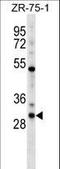 Homeobox D1 antibody, LS-C164988, Lifespan Biosciences, Western Blot image 