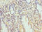 Proteasome Subunit Beta 10 antibody, LS-C676317, Lifespan Biosciences, Immunohistochemistry paraffin image 