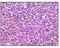 MCL1 Apoptosis Regulator, BCL2 Family Member antibody, NB100-2194, Novus Biologicals, Immunohistochemistry frozen image 