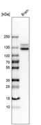 Neural Cell Adhesion Molecule 1 antibody, HPA039835, Atlas Antibodies, Western Blot image 