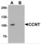 Cyclin T1 antibody, NBP2-81898, Novus Biologicals, Western Blot image 