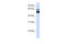 Sphingomyelin Phosphodiesterase 1 antibody, 25-269, ProSci, Western Blot image 