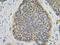 Fibroblast Growth Factor 10 antibody, XP-5131, ProSci, Immunohistochemistry paraffin image 