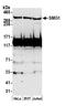 SMG1 Nonsense Mediated MRNA Decay Associated PI3K Related Kinase antibody, A300-394A, Bethyl Labs, Western Blot image 
