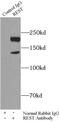 NRSF antibody, FNab07244, FineTest, Immunoprecipitation image 