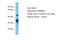 PRAME Family Member 2 antibody, A16569, Boster Biological Technology, Western Blot image 