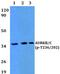 Aurora Kinase B antibody, PA5-36030, Invitrogen Antibodies, Western Blot image 