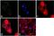 Protein Tyrosine Kinase 2 antibody, 44-626G, Invitrogen Antibodies, Immunofluorescence image 