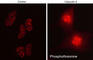 Phosphothreonine antibody, PP4641, ECM Biosciences, Immunocytochemistry image 