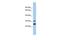 NSE2 (MMS21) Homolog, SMC5-SMC6 Complex SUMO Ligase antibody, PA5-44399, Invitrogen Antibodies, Western Blot image 