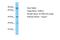 Tubulin Alpha Like 3 antibody, A15933, Boster Biological Technology, Western Blot image 