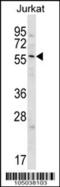 Glypican 3 antibody, 62-255, ProSci, Western Blot image 