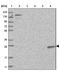 Troponin I1, Slow Skeletal Type antibody, NBP1-90923, Novus Biologicals, Western Blot image 