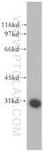 GTPase, IMAP Family Member 2 antibody, 13445-1-AP, Proteintech Group, Western Blot image 