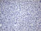 Thyroglobulin antibody, LS-C798149, Lifespan Biosciences, Immunohistochemistry paraffin image 