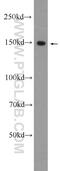 Carbamoyl-Phosphate Synthase 1 antibody, 24513-1-AP, Proteintech Group, Western Blot image 