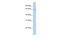 Peptidylprolyl Isomerase Like 2 antibody, A11451, Boster Biological Technology, Western Blot image 