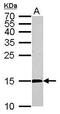 Cytidine Deaminase antibody, GTX101673, GeneTex, Western Blot image 