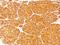 Tyrosinase antibody, NBP2-25238, Novus Biologicals, Immunohistochemistry paraffin image 