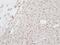 Colony Stimulating Factor 3 Receptor antibody, ab126167, Abcam, Immunohistochemistry paraffin image 
