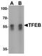 Transcription Factor EB antibody, A00662, Boster Biological Technology, Western Blot image 