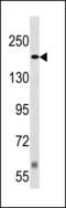 TSC Complex Subunit 2 antibody, LS-C203818, Lifespan Biosciences, Western Blot image 