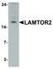 Late Endosomal/Lysosomal Adaptor, MAPK And MTOR Activator 2 antibody, LS-C336138, Lifespan Biosciences, Western Blot image 