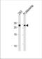 Transcription Factor 21 antibody, TA324412, Origene, Western Blot image 